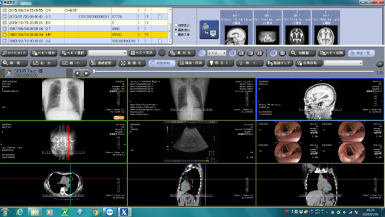 画像管理システム（PACS)「Xronos」